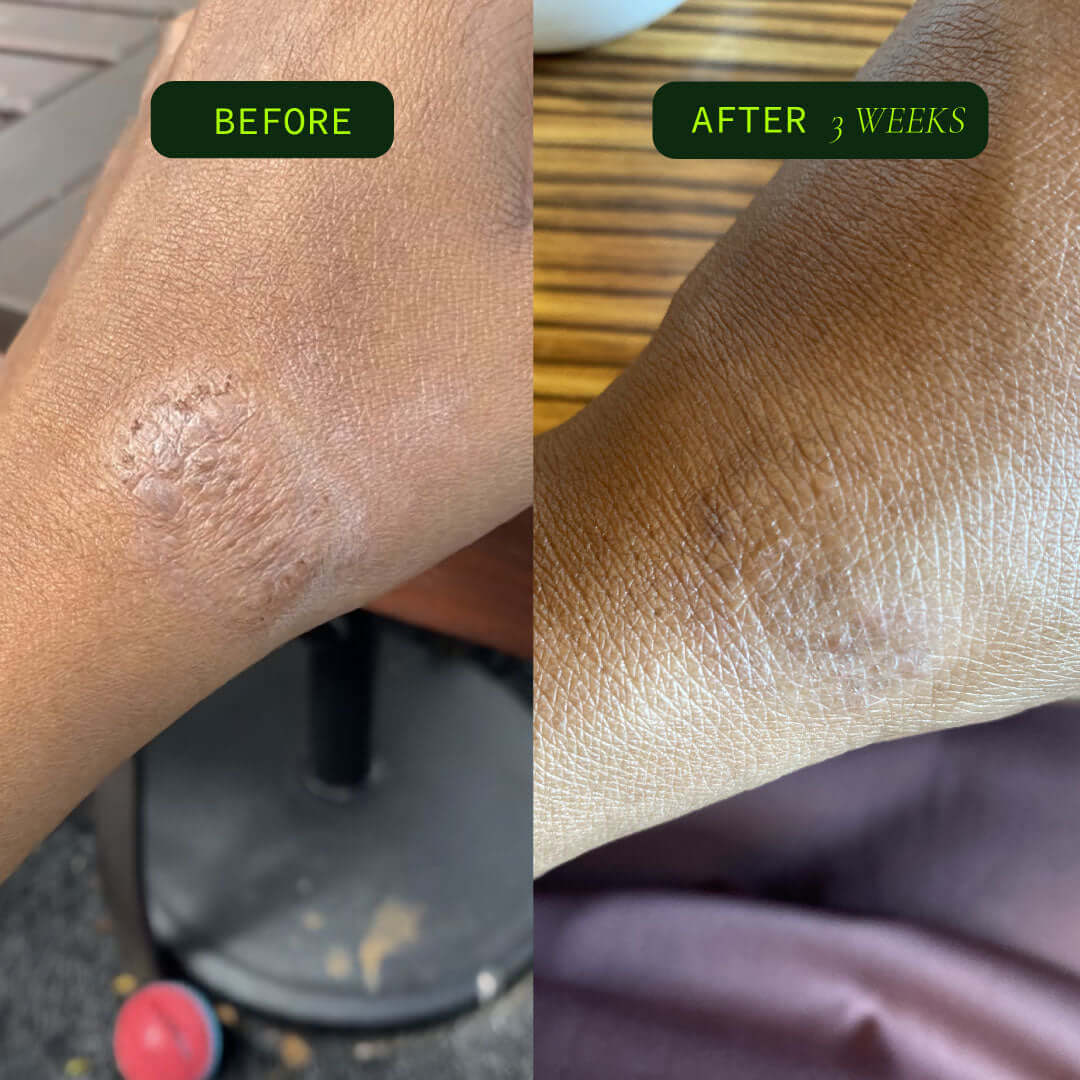 Omega Body Oil: Unscented